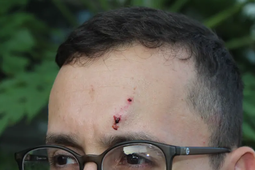 Enfermeiro agredido. Socorrista levou uma coronhada na testa