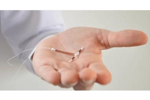DIU de cobre é reconhecido por sua alta eficácia e por ser um método contraceptivo de longa duração