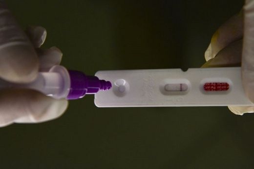 Previsão da gravidade da covid. Estudo é do Instituto de Química de São Carlos