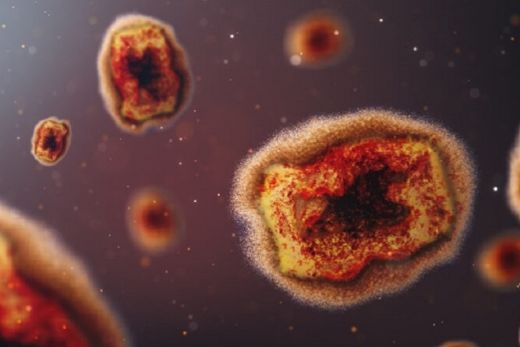 Vírus Monkeypox. Transmissão ocorre por contato próximo a lesões na pele
