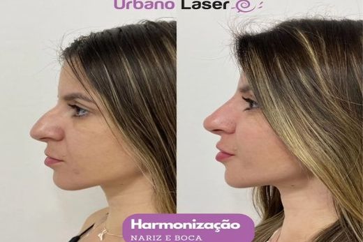 Urbano Laser Matão celebra primeiro ano — foto 3 de 4