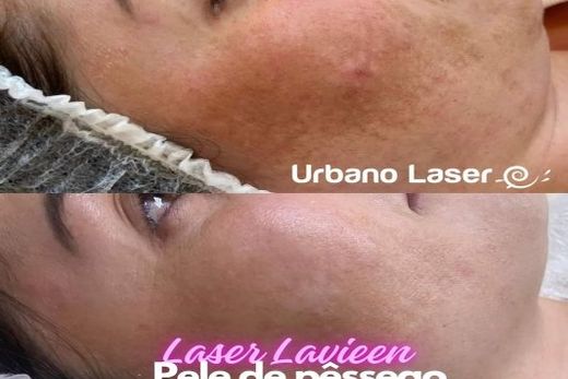 Urbano Laser Matão celebra primeiro ano — foto 4 de 4